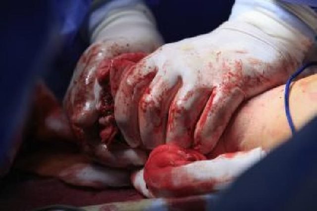 18PrinciplesOfBleedingControl